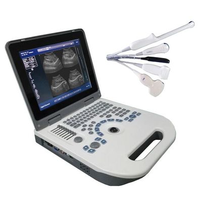 Qualität  TGC Control Notebook Ultrasound Scanner For Pregnancy Home Use Fabrik