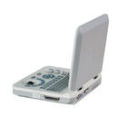 15 Zoll LED Farb-Ultraschallgerät, tragbar, mit 60-Grad-Scanwinkel und ≥250mm Anzeigetiefe