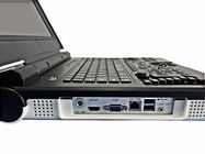 15-Zoll-LED-Farb-Portable-Ultraschallmaschine mit 60-Grad-Scan-Winkel und Konfigurationssonde 2.0MHz-5.0MHz