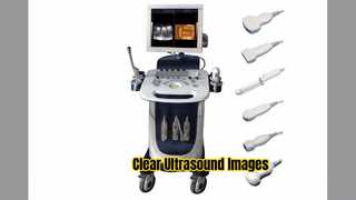 Doppler-Ultraschallscanner PW CFM PDI-Modus