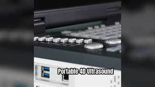Tragbares 4D-Doppler-Ultraschallgerät, bereit für die Intensivstation