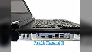 Tragbarer Farbdoppler-Ultraschall E0 Urologie-Scan